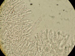 Cylindrobasidium laeve