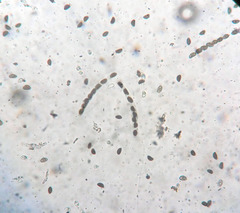 Hypoxylon cercidicola