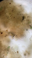 Stentor muelleri