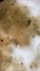 Stentor muelleri