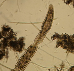 Stenostomum constrictum