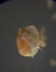 Quinqueloculina