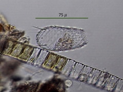 Euglypha acanthophora