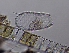 Euglypha acanthophora
