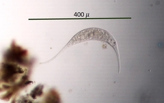 Amphileptus procerus