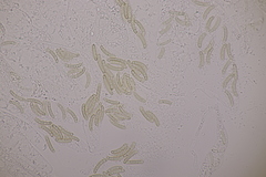 Cryptosphaeria eunomia