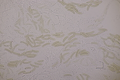 Cryptosphaeria eunomia