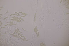 Cryptosphaeria eunomia