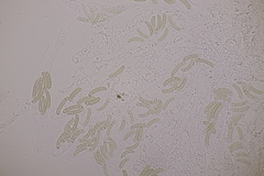 Cryptosphaeria eunomia