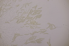 Cryptosphaeria eunomia