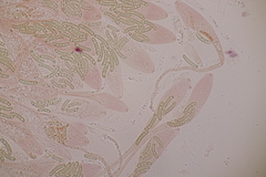 Cryptosphaeria eunomia