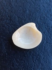 Bivalvia