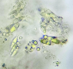 Anisomeridium biforme