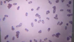 Pseudoomphalina compressipes