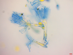 Phyllactinia angulata