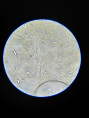 Coccomyces dentatus