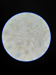 Coccomyces dentatus