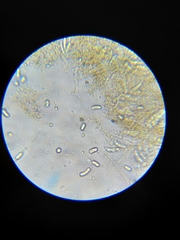 Coccomyces dentatus