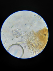 Coccomyces dentatus