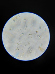 Coccomyces dentatus
