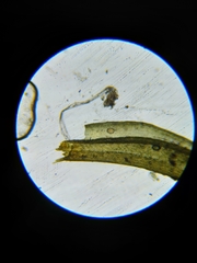 Grimmia trichophylla