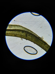 Grimmia trichophylla