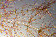 Antithamnionella glandifera