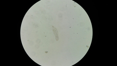 Gastrotricha