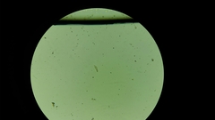 Gastrotricha