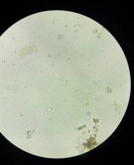 Fragilaria