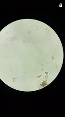 Fragilaria