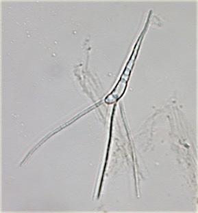 Culicidospora