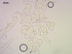 Botrytis