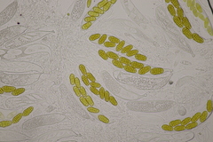 Stemphylium vesicarium