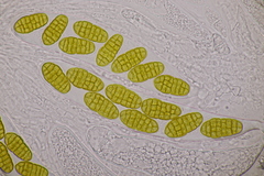 Stemphylium vesicarium