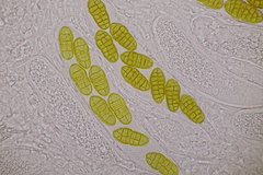 Stemphylium vesicarium