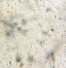 Carcinomyces effibulatus