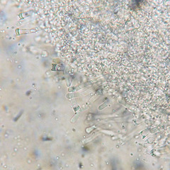 Carcinomyces effibulatus