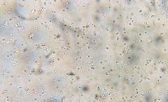 Carcinomyces effibulatus