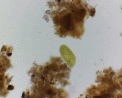 Paramecium bursaria