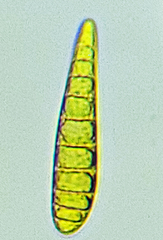Patellaria atrata