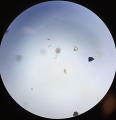 Elphidium limbatum