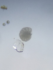 Elphidium limbatum