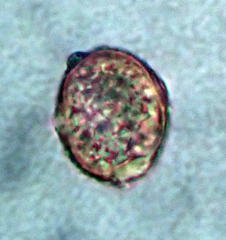 Puccinia unciniarum