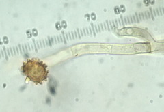 Pseudotomentella tristis