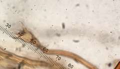 Pseudotomentella tristis