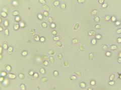 Tricholoma intermedium