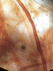 Pseudotomentella tristis