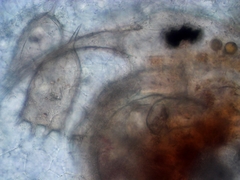 Actinosphaerium eichhornii