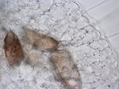 Actinosphaerium eichhornii
